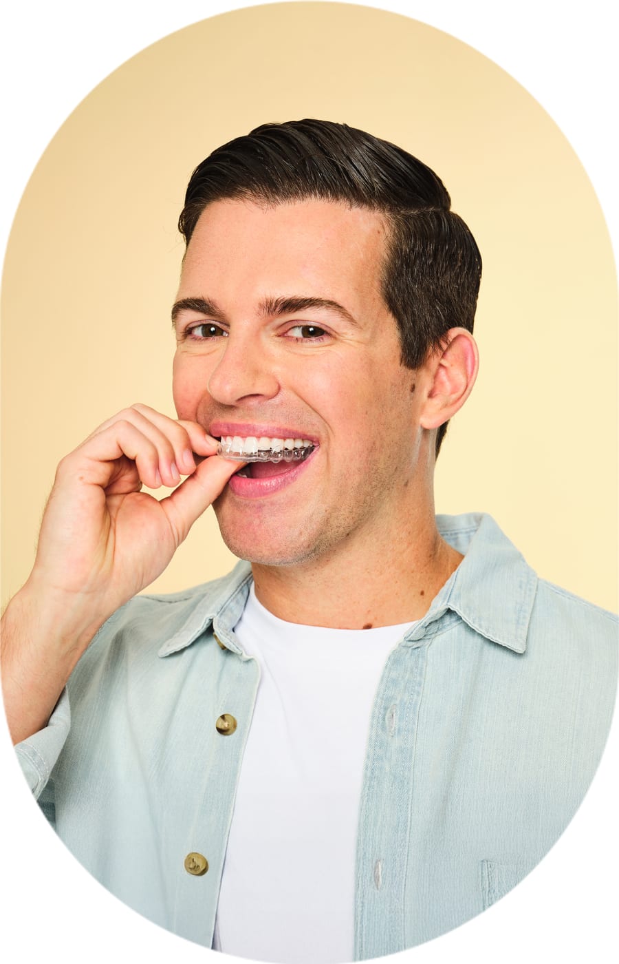 A man is smiling and putting in clear aligners.