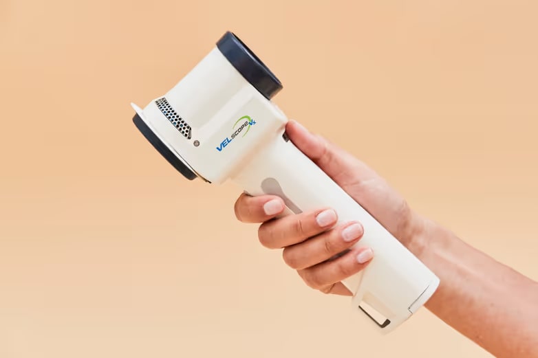 Image of VELscope Technology at Tend