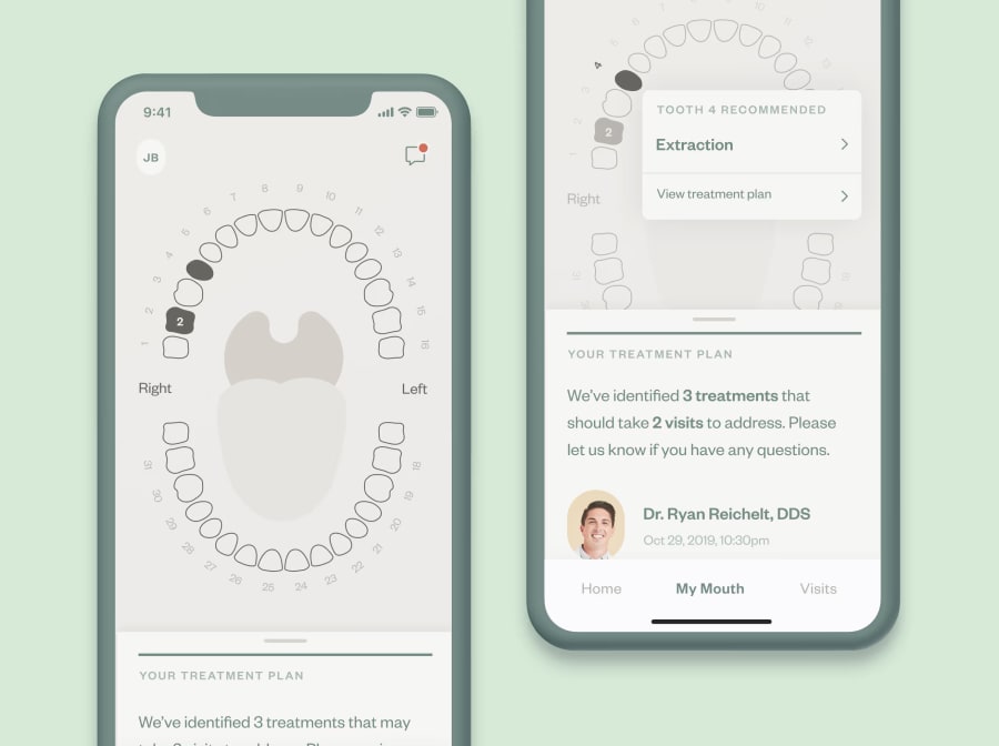 Illustration of 2 smartphones showing examples of treatment recommendations displayed on the Tend app.